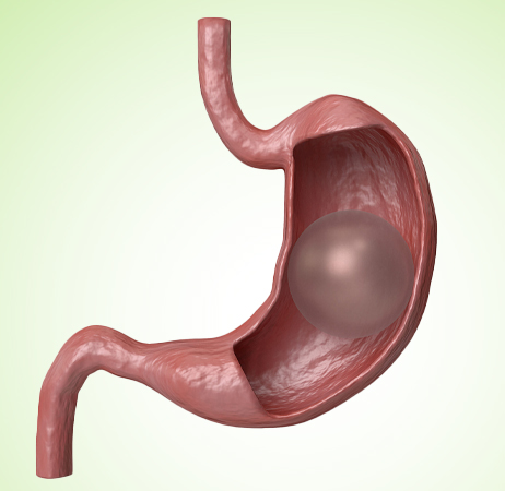 الكبسولة المبرمجة