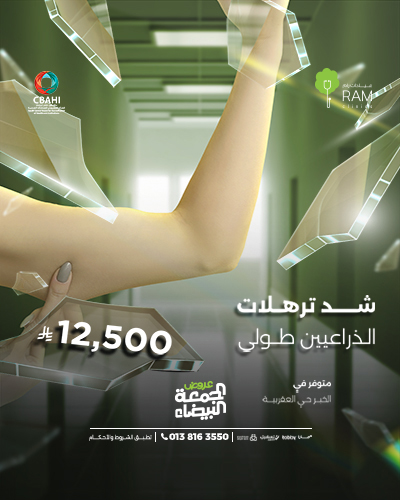 شد ترهلات الذراعيين طولى