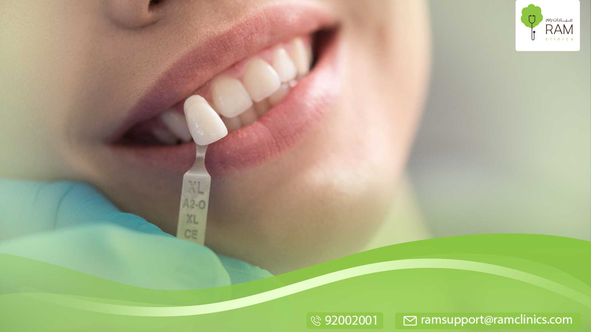 زراعة الأسنان