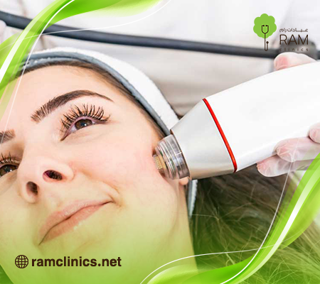 تقنية-انفيني