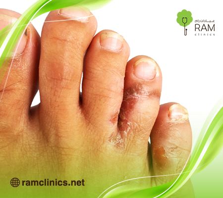 القدم الرياضية