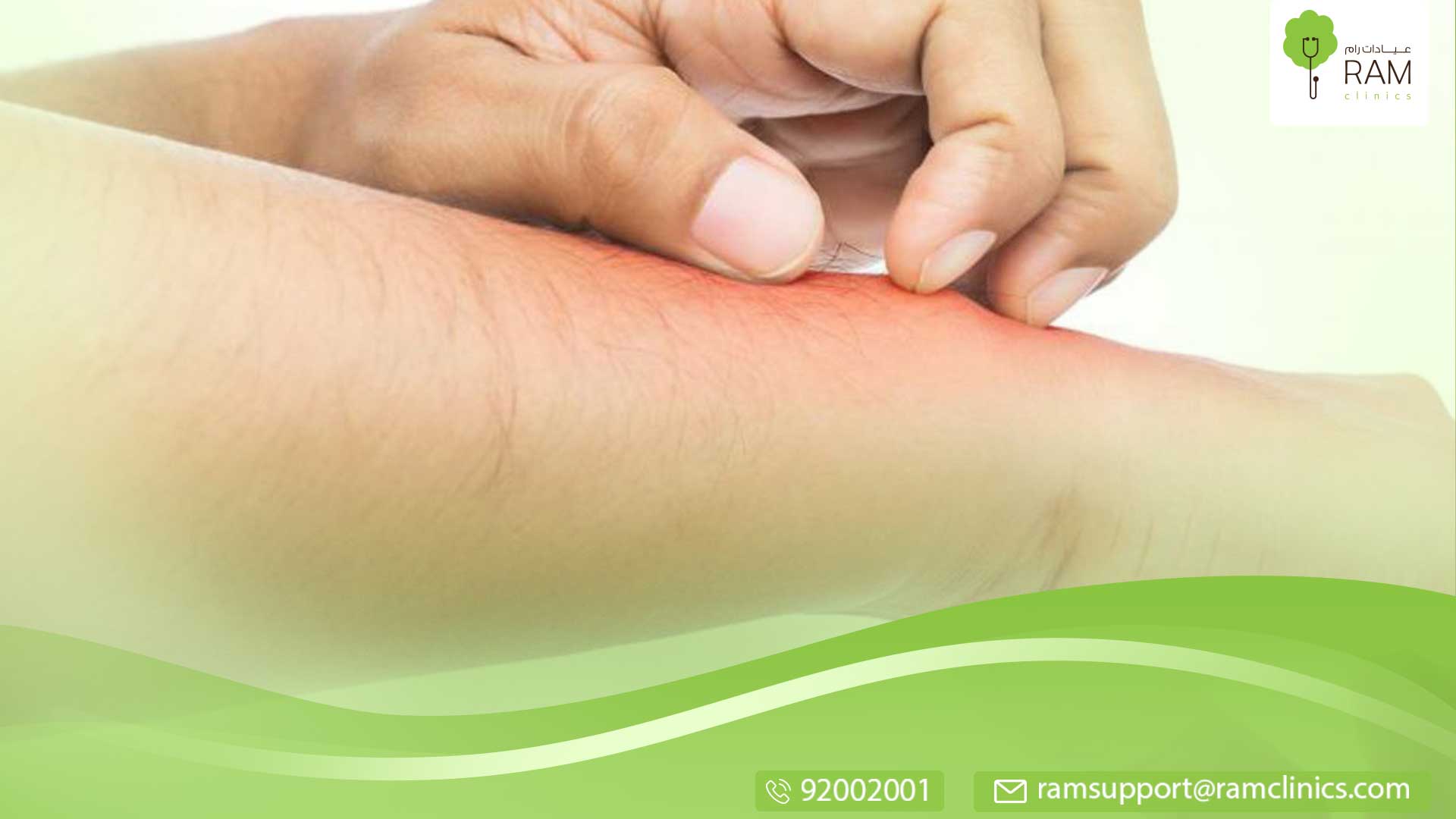 الطفح الجلدي