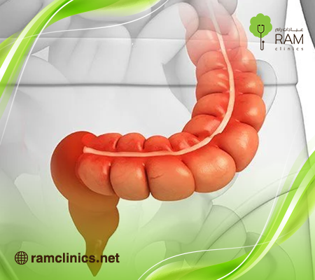 التهاب القولون