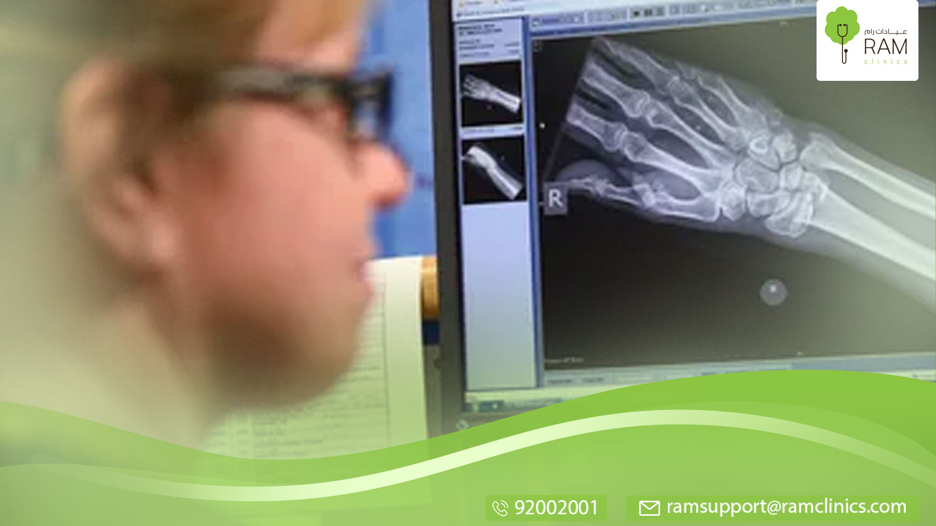 اعراض هشاشة العظام