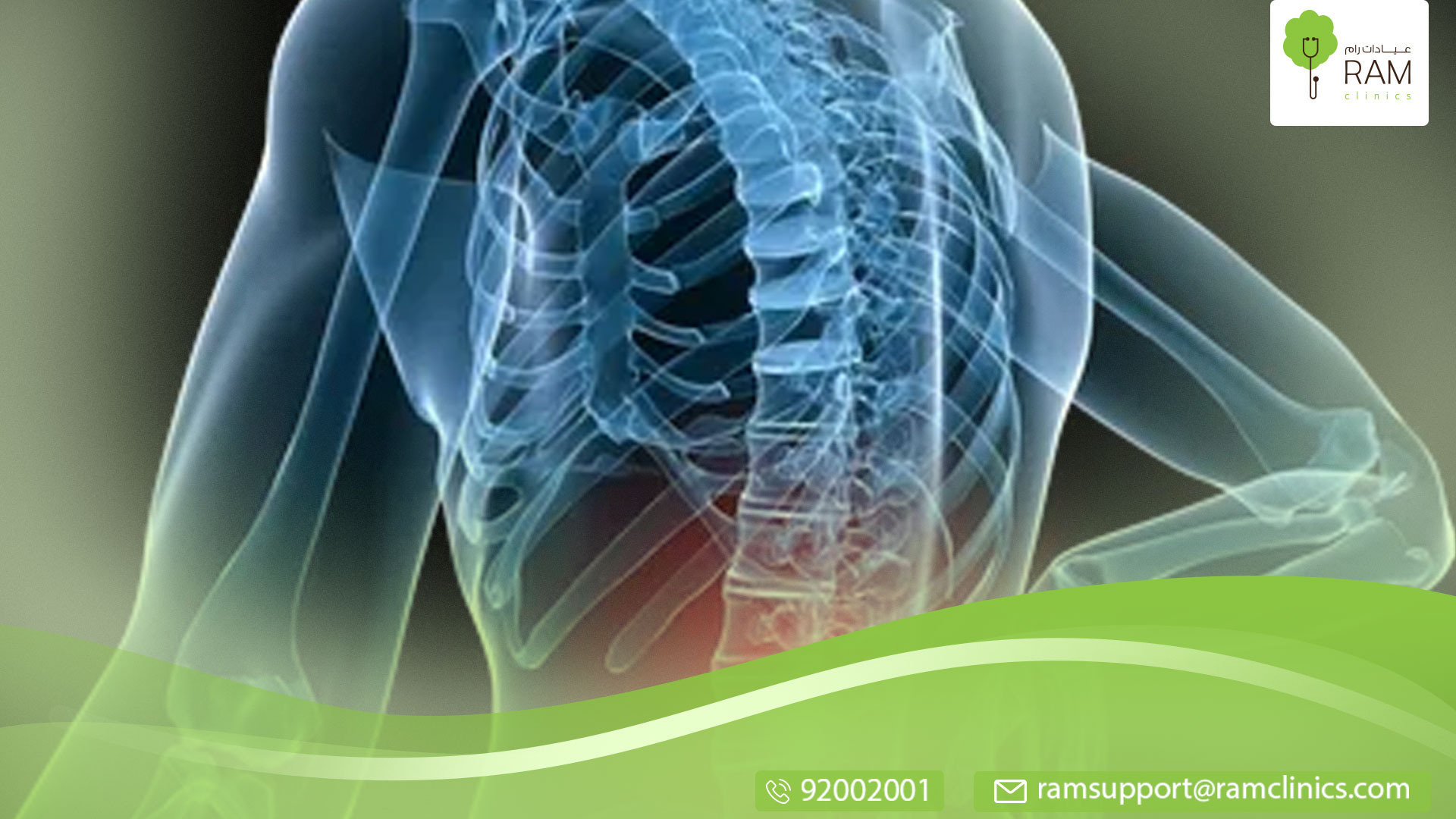 انزلاق غضروفي