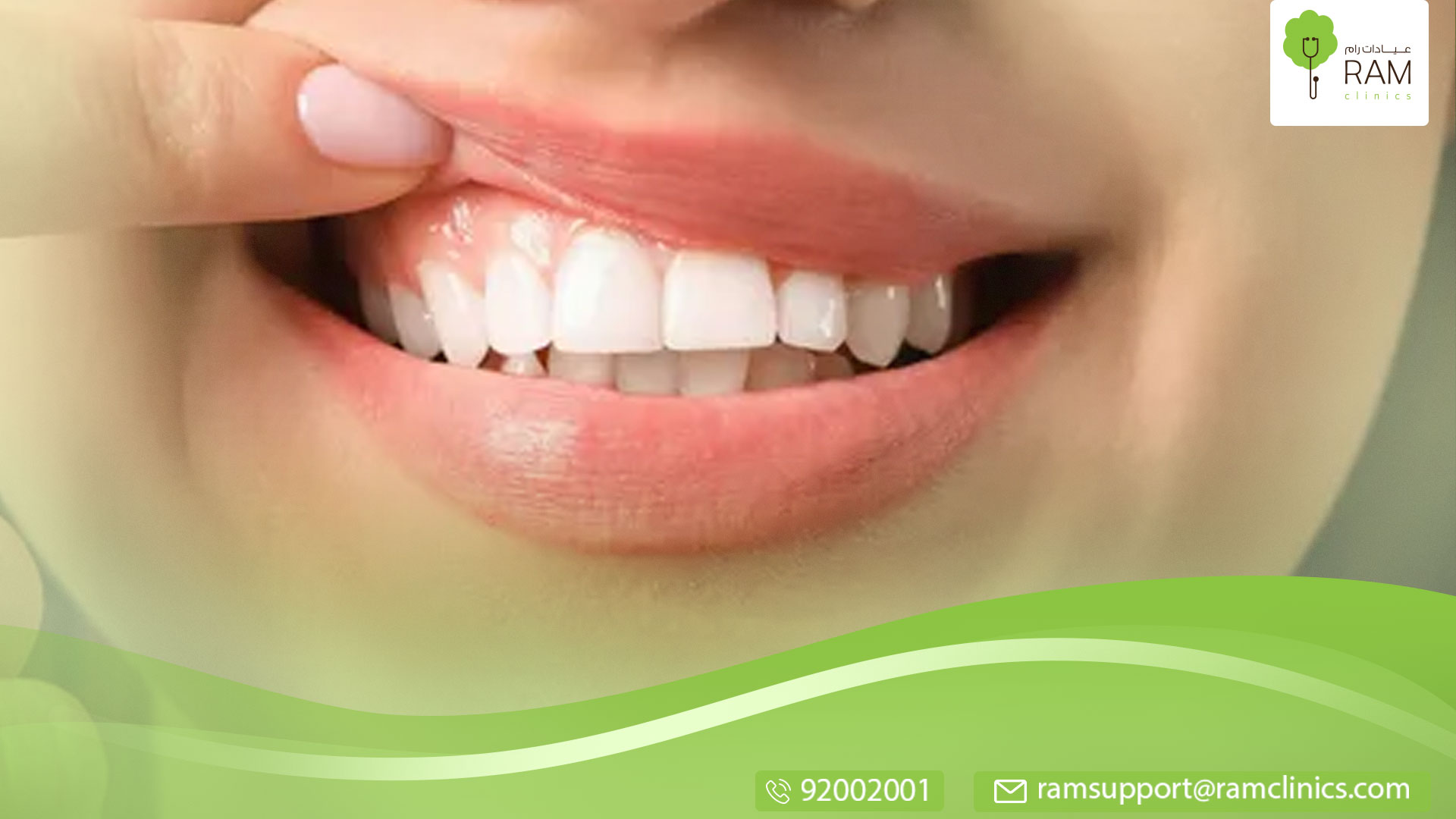 عملية-تحريك-اللثة