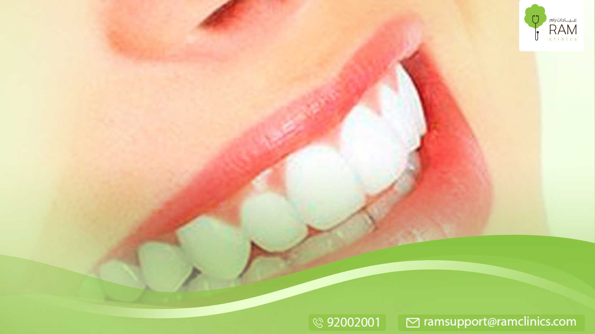 هل الفحم يبيض الاسنان