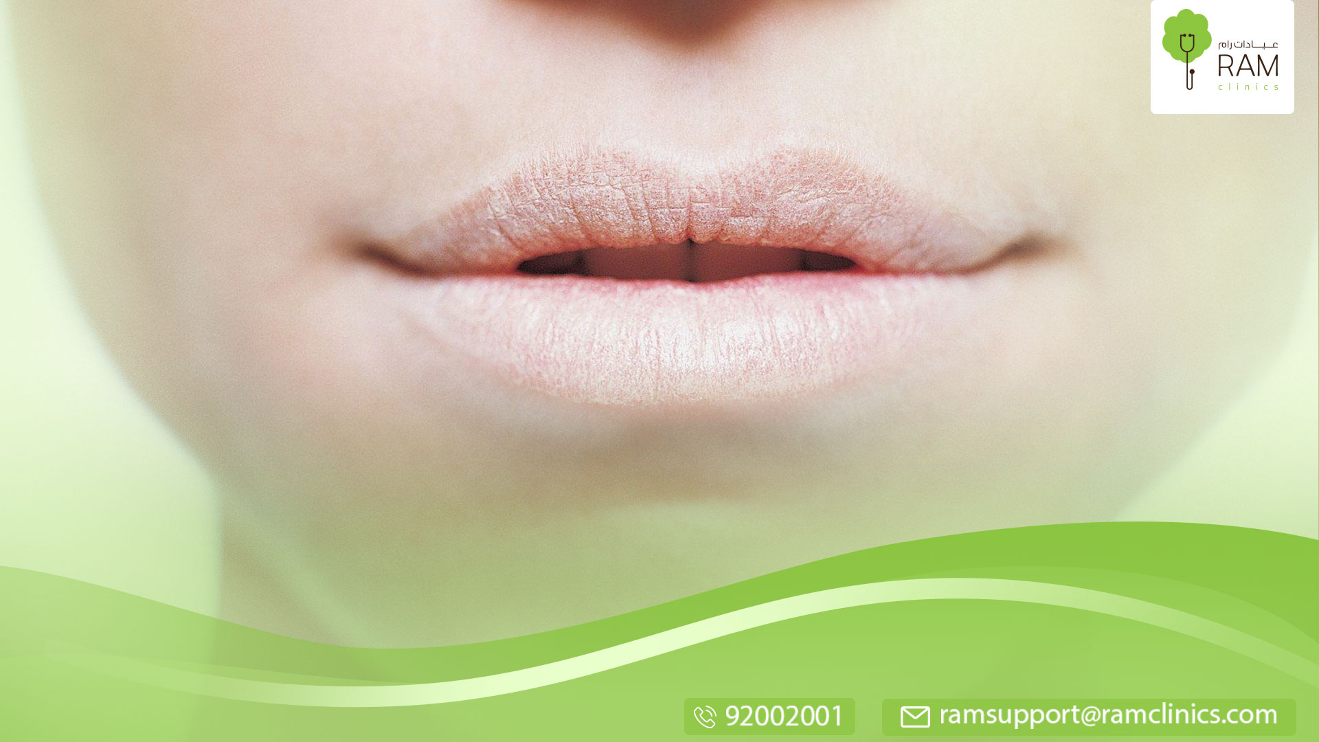 جفاف الشفايف