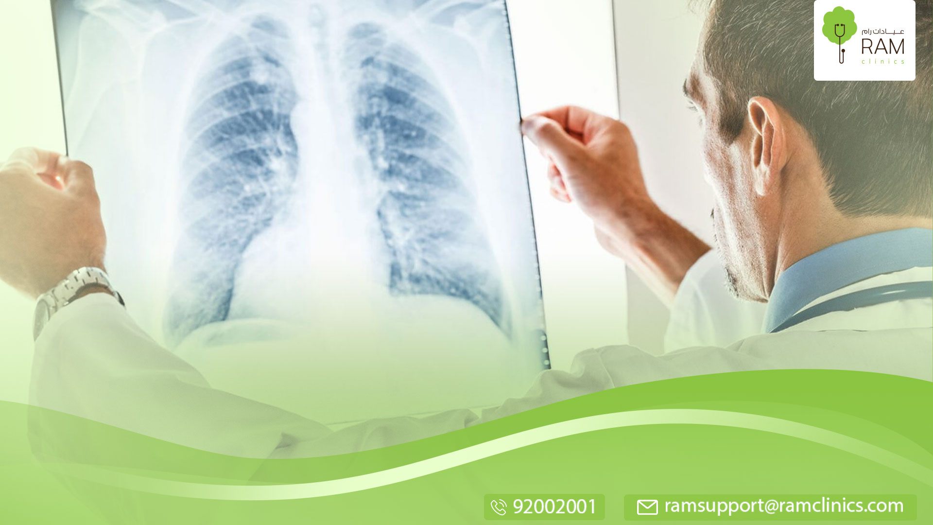 العلاج الاشعاعي