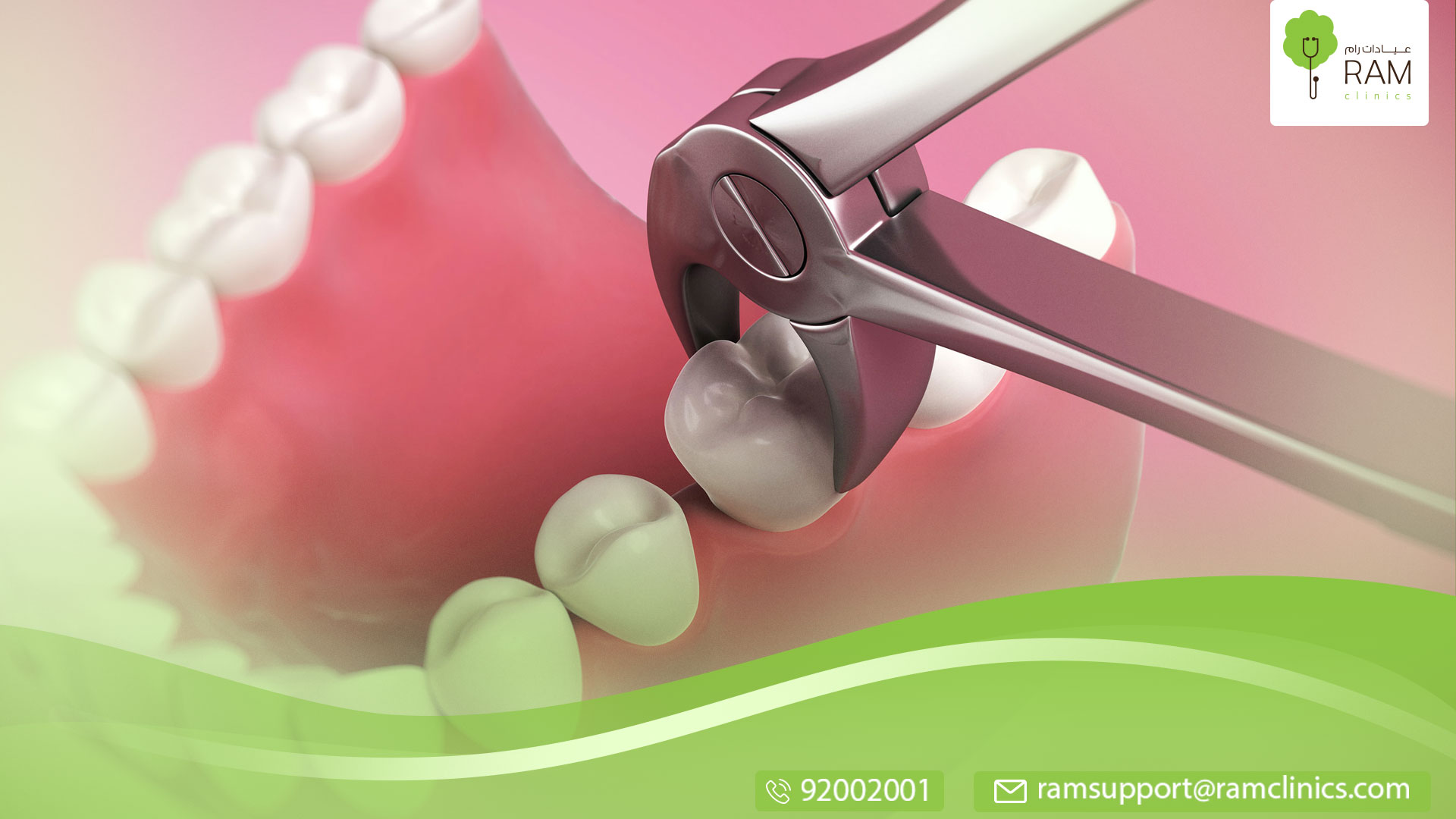 كيفية العناية بـ ضرس العقل