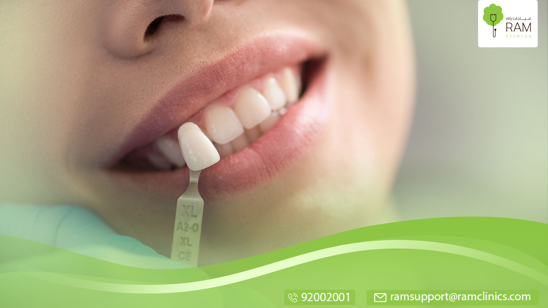 كيف تصنع حشوة الاسنان