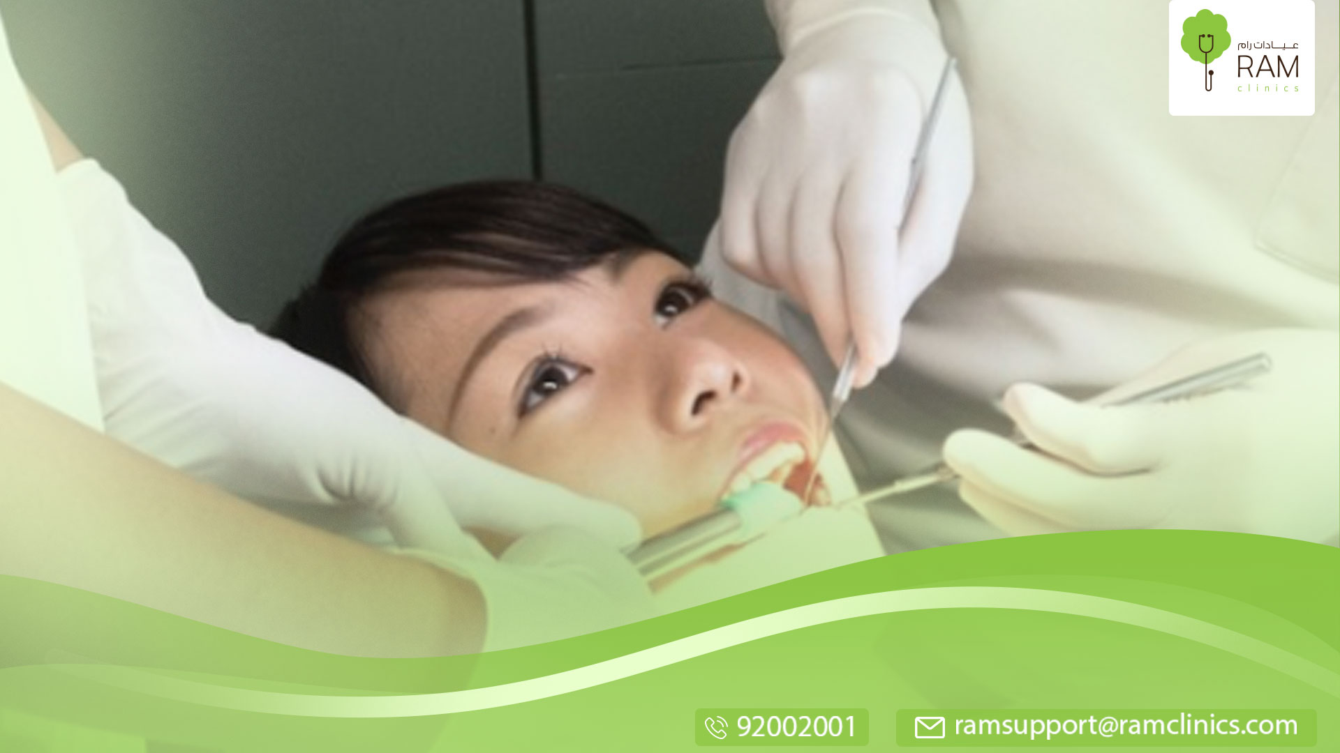 مضاعفات خلع ضرس العقل