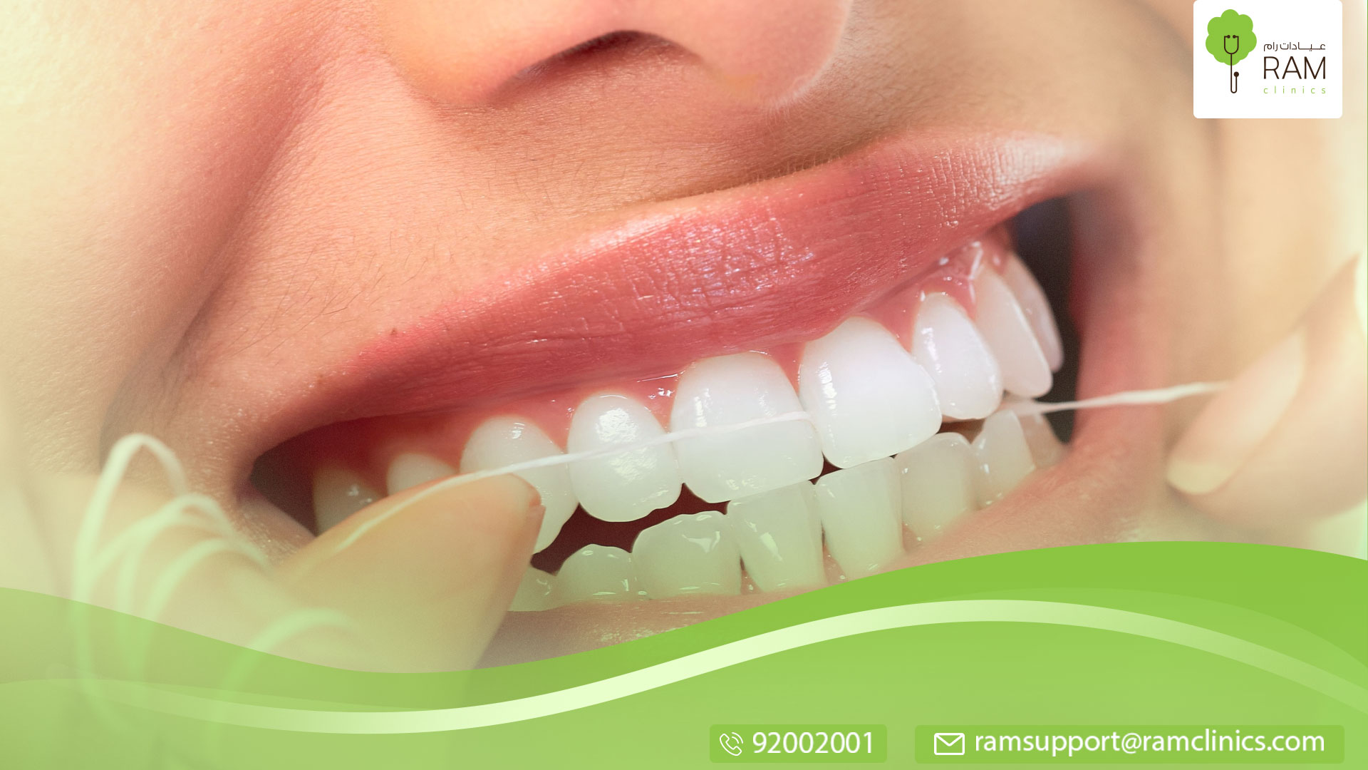 الخيط الطبي للأسنان