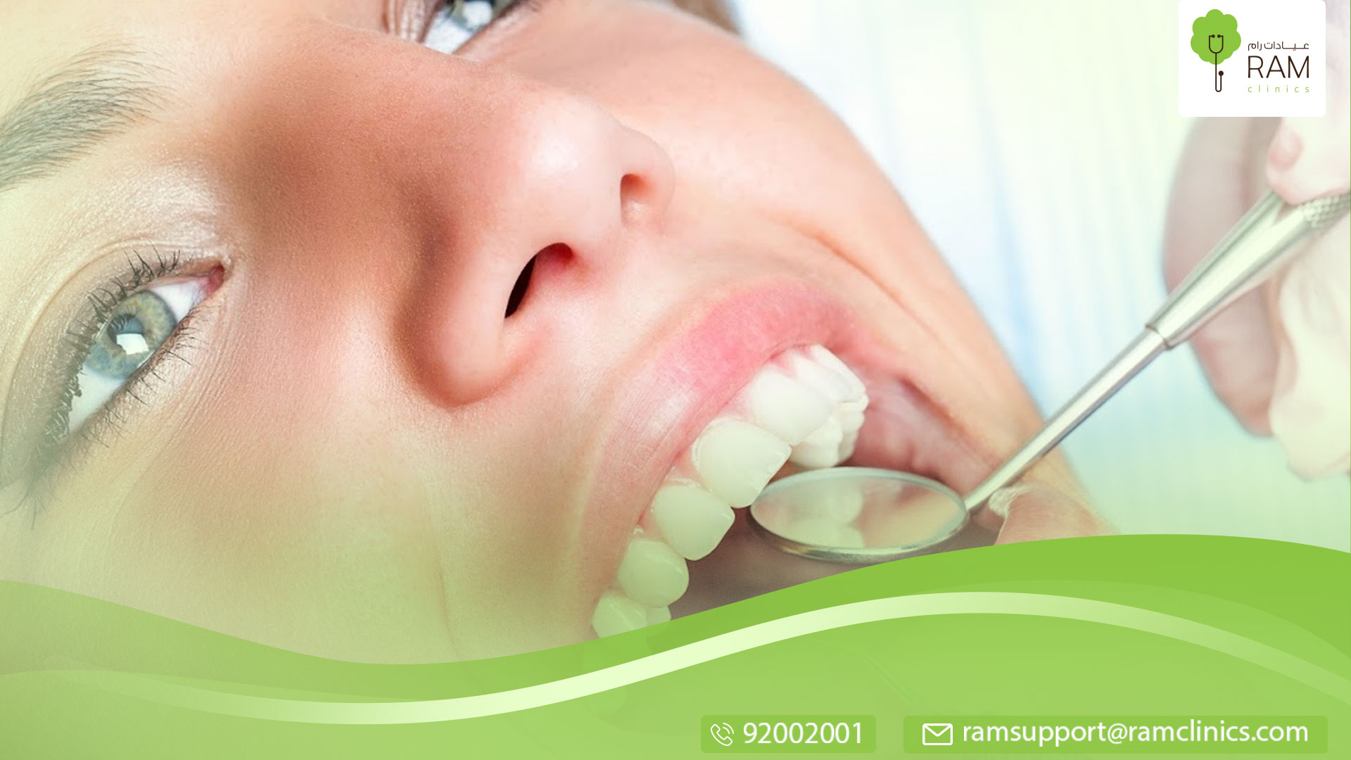 التسوس الخفي