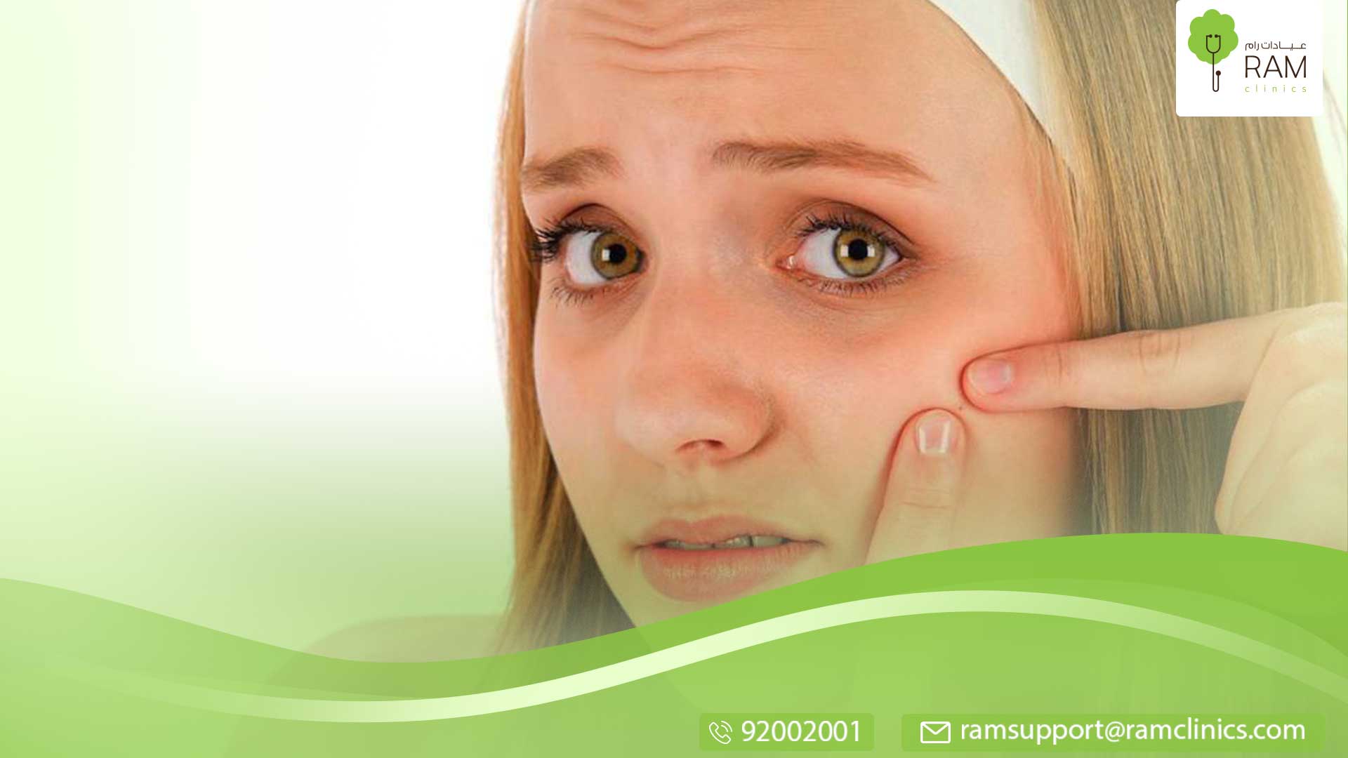 البثور السوداء