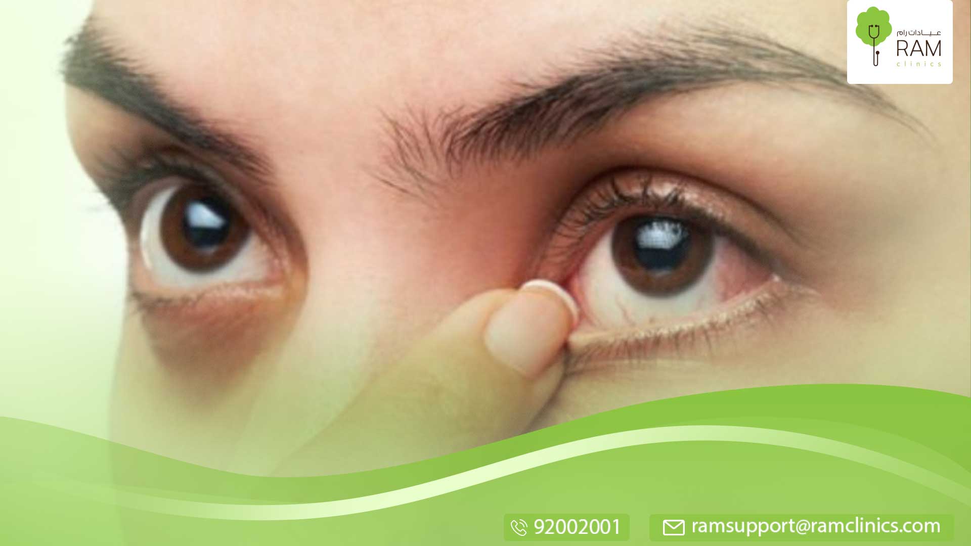 فيلر تحت العينين