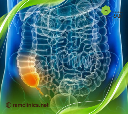 الزائدة الدودية