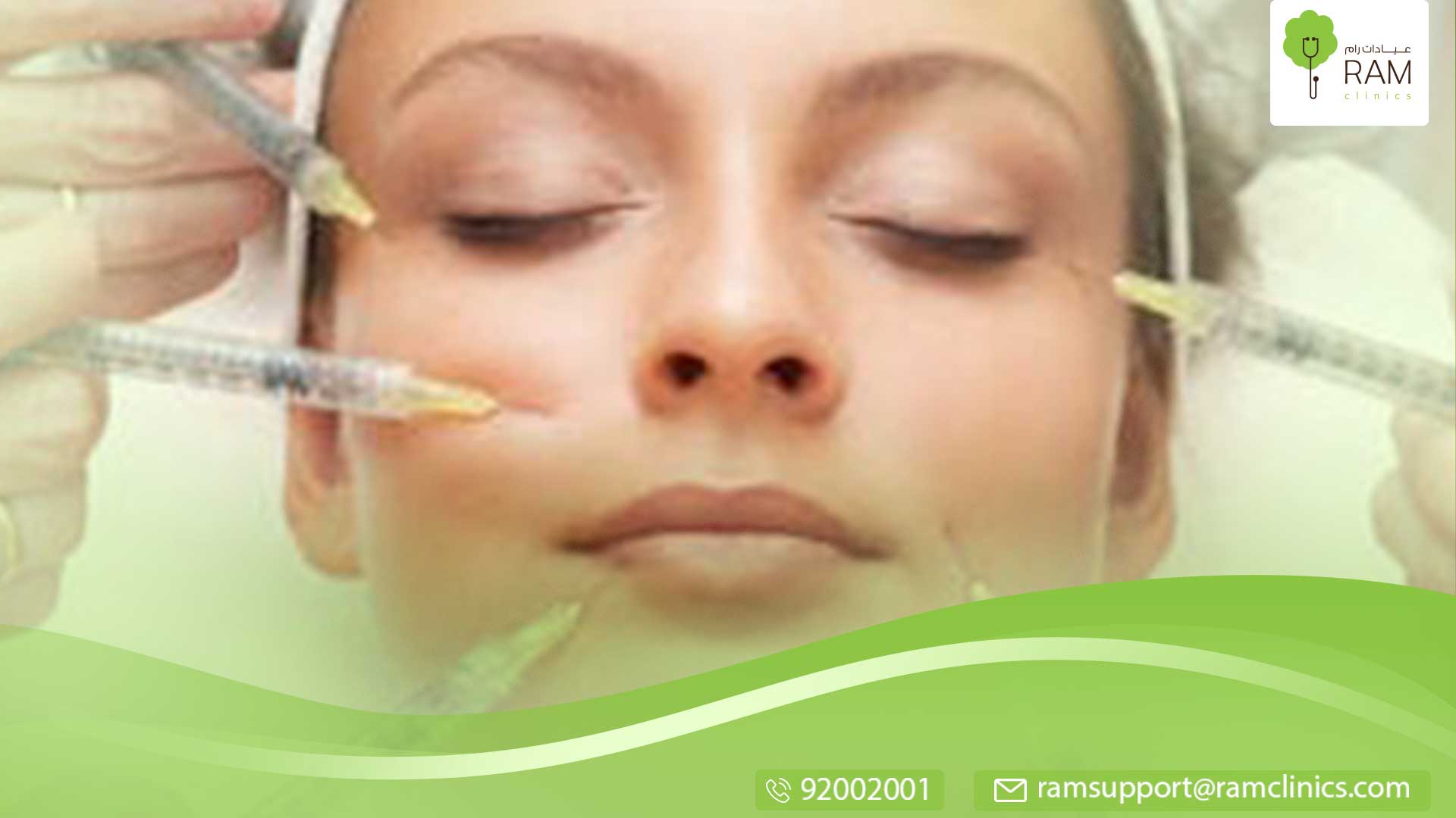 البوتوكس لعلاج التعرق الزائد