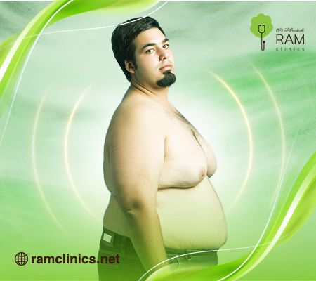 علاج التثدي عند الرجال