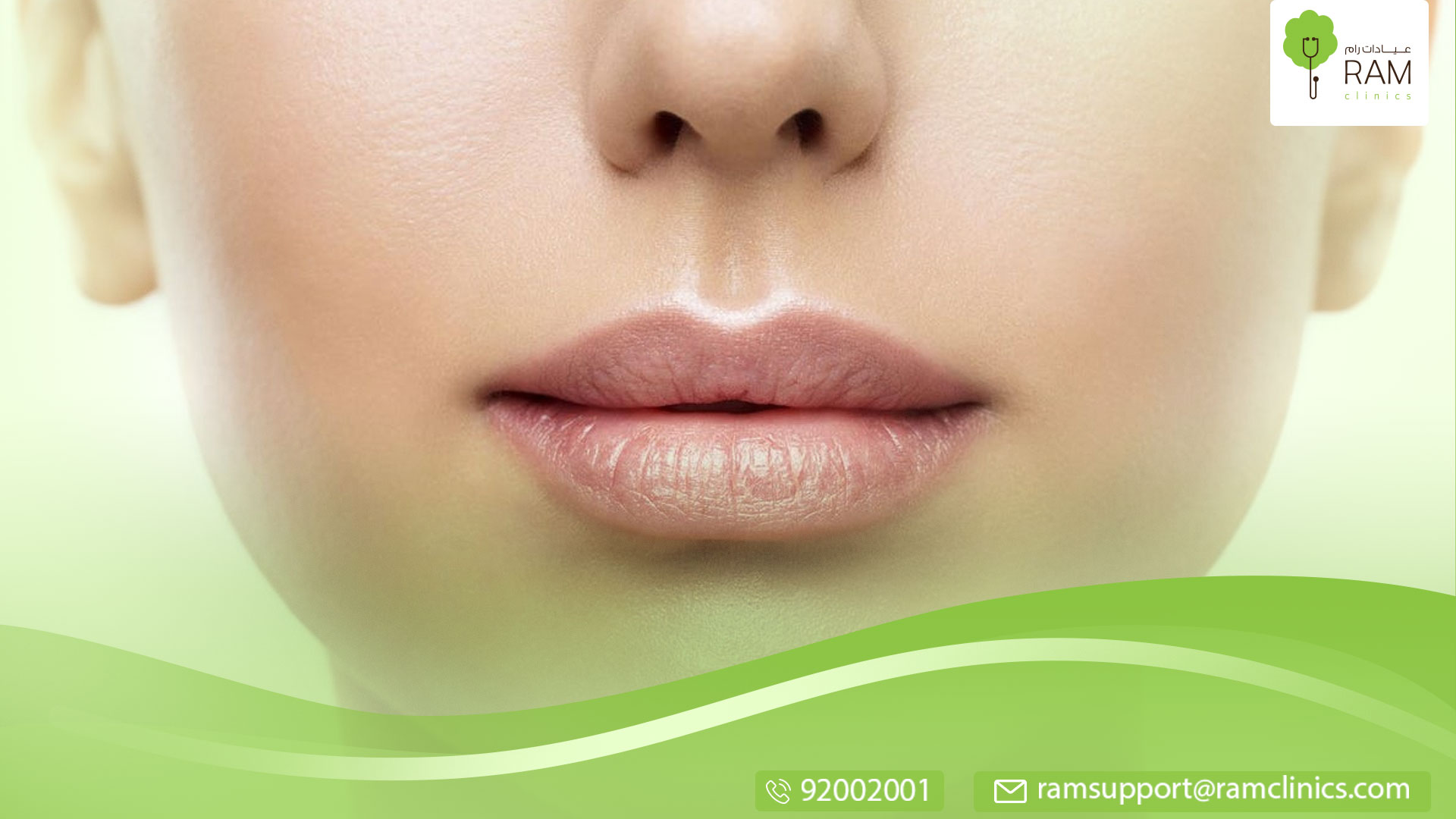 علاج الشفة الارنبية