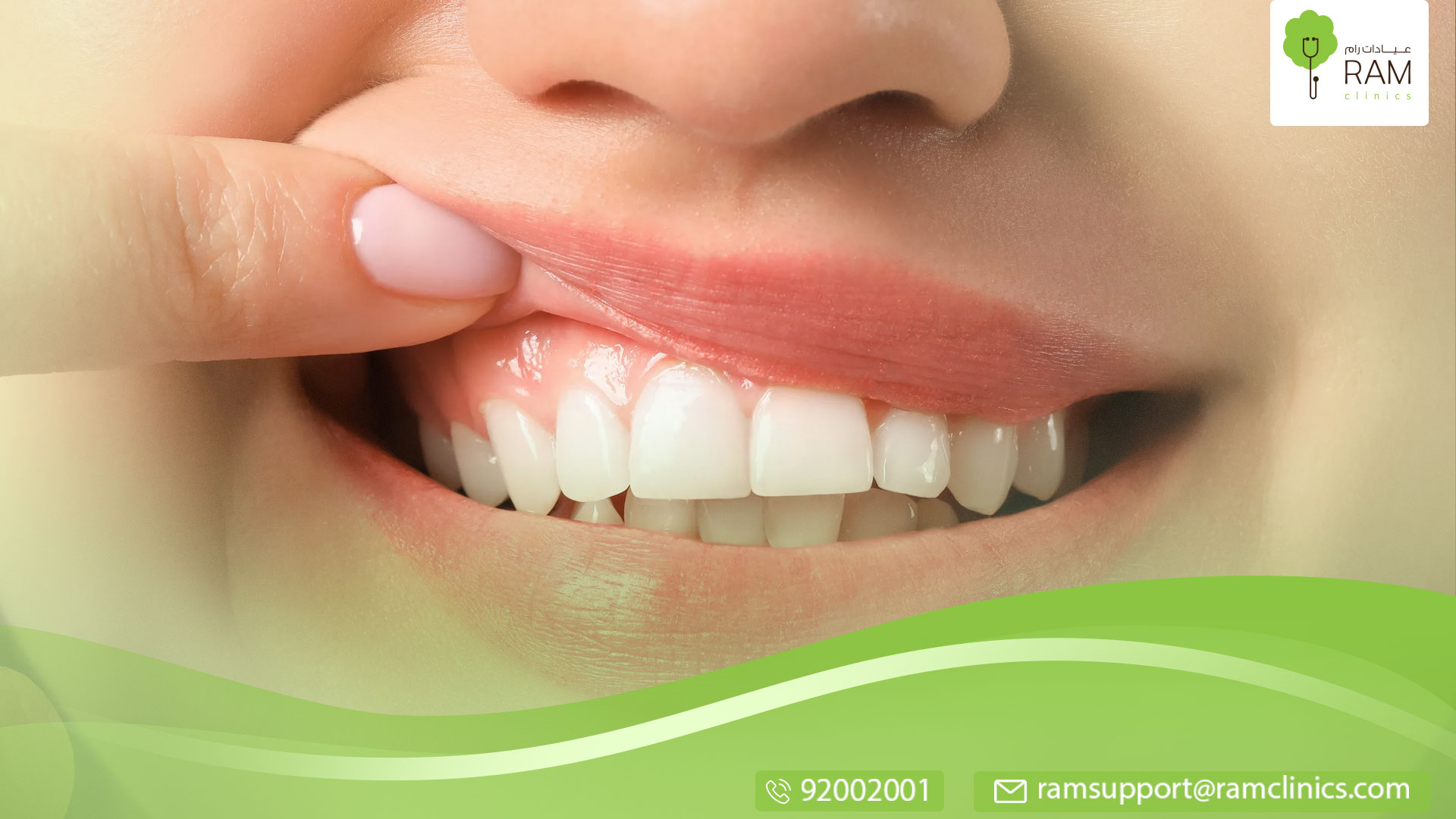 أسباب نزيف اللثة