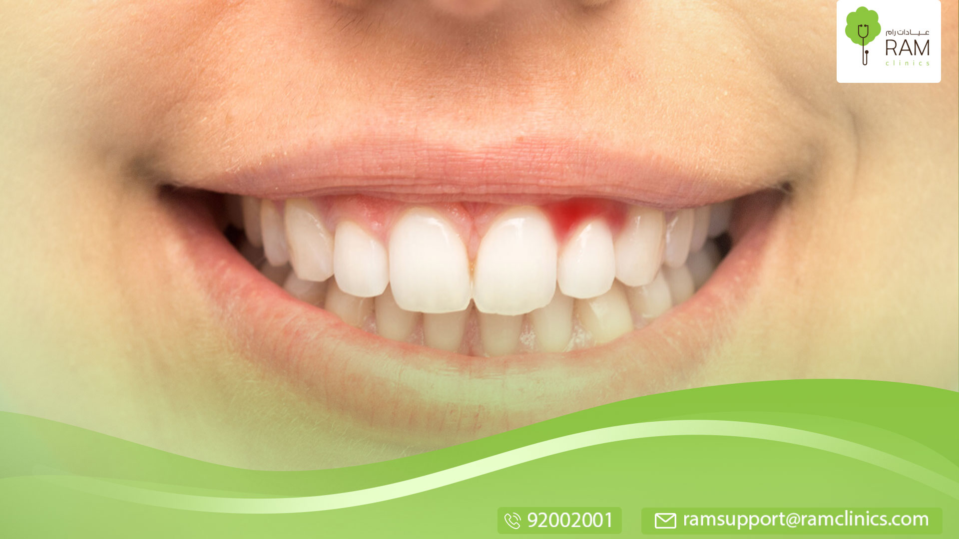 وصفة لعلاج اللثة والأسنان