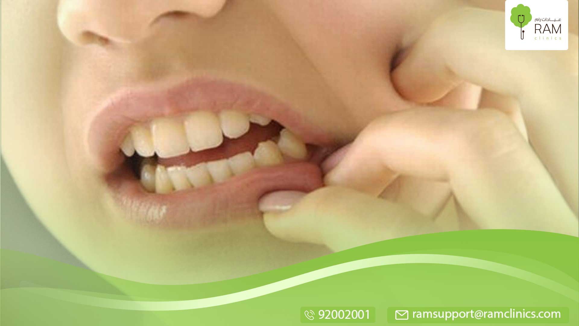 اسباب حساسية الاسنان