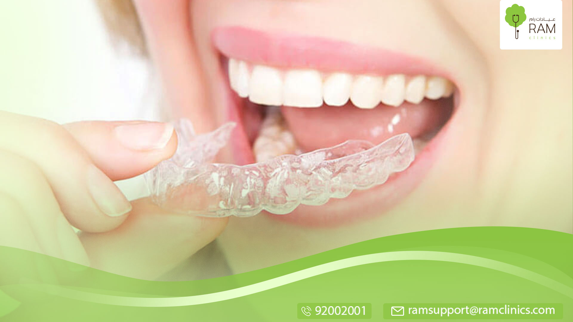 مقوم الاسنان الشفاف