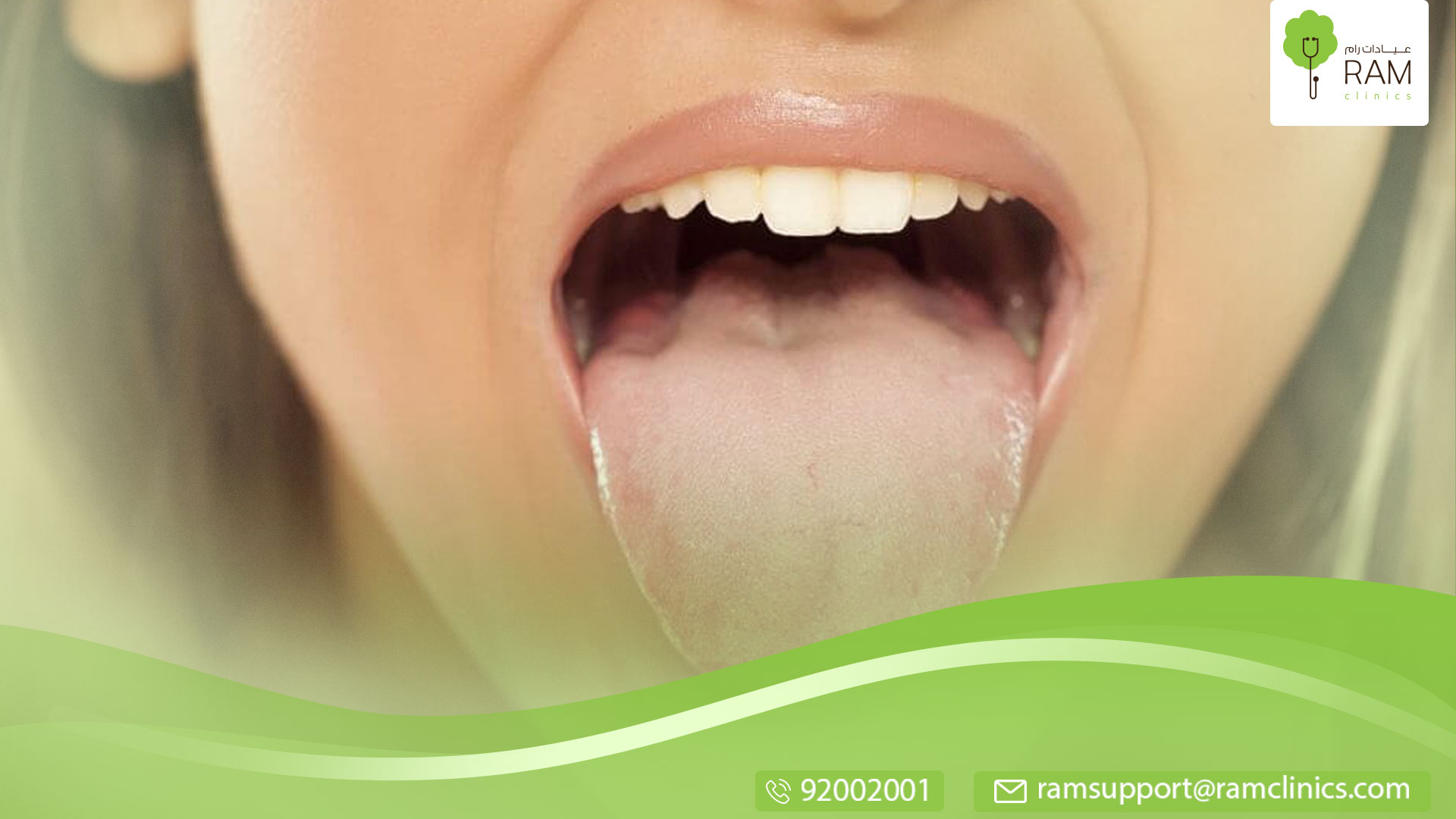 علاج امراض اللسان