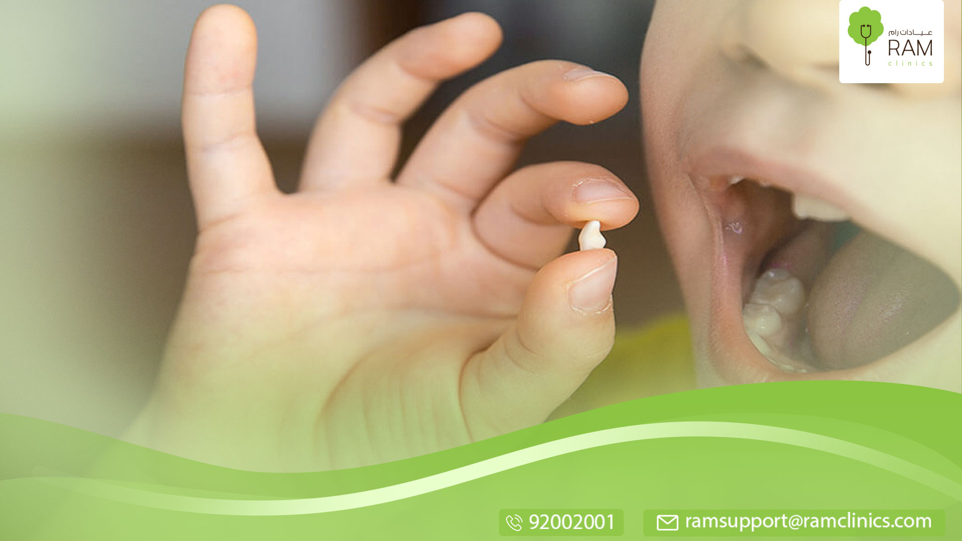 سقوط الأسنان الدّائمة عند الأطفال