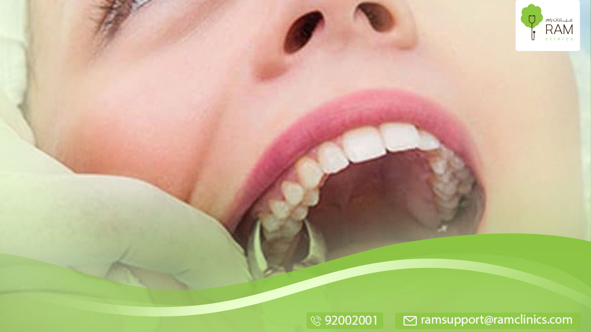 نصائح بعد خلع الضرس