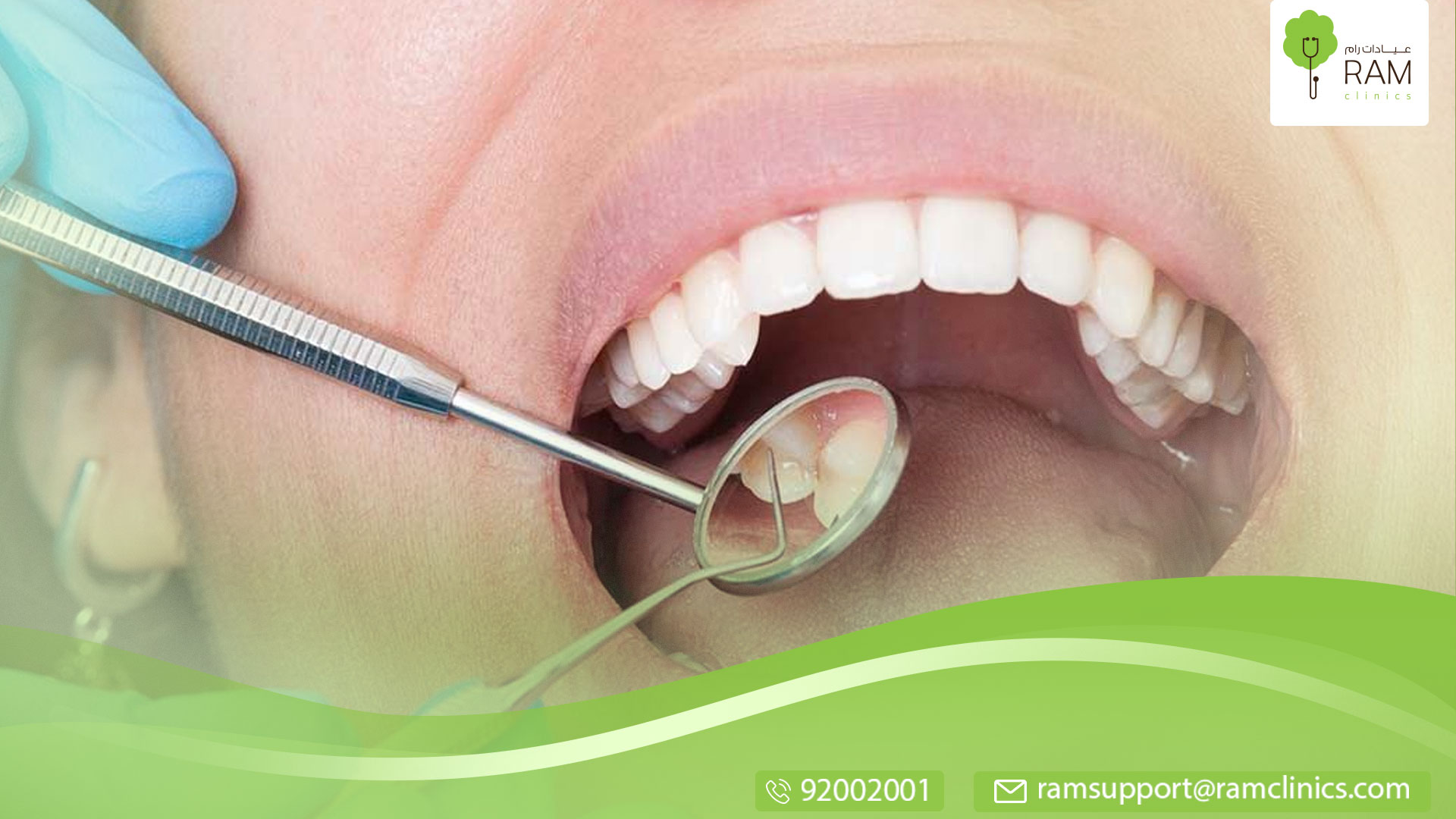 علاج خراج الاسنان الداخلي