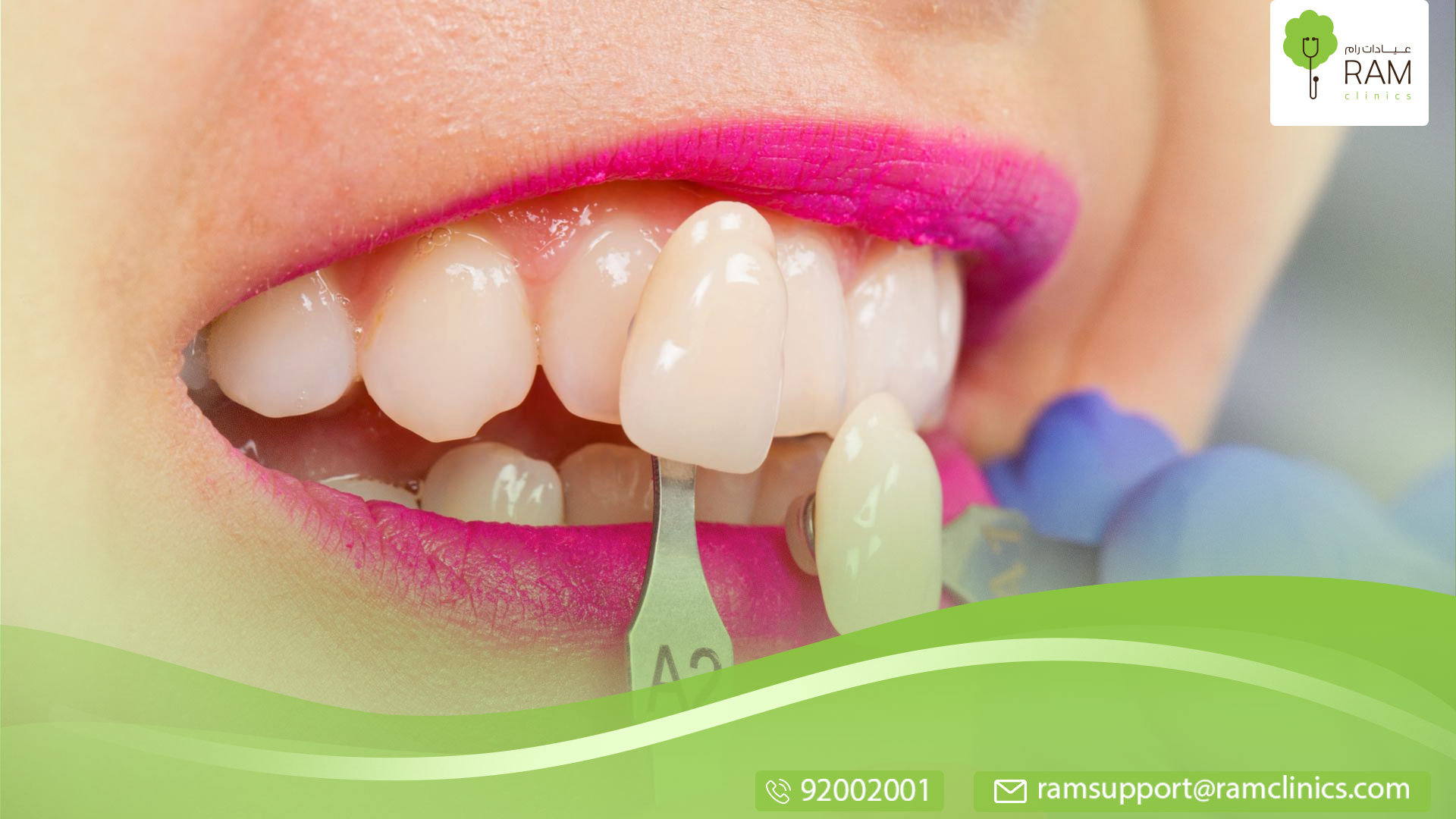 انواع حشوه اسنان