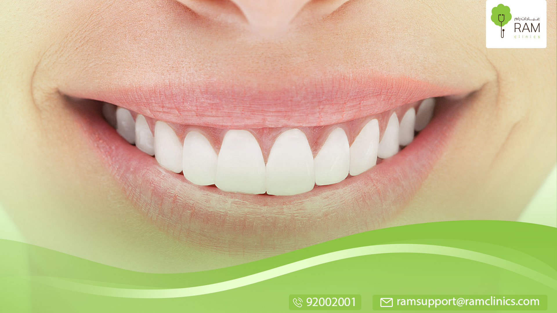 جير الأسنان الأسود