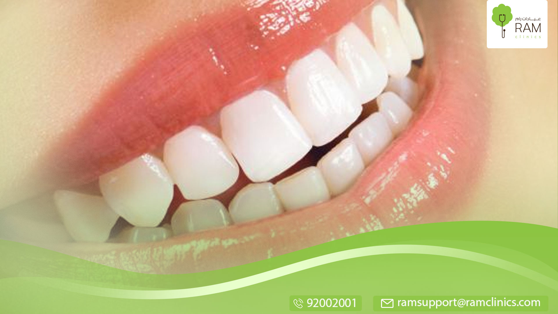 جسور الاسنان وانواعها