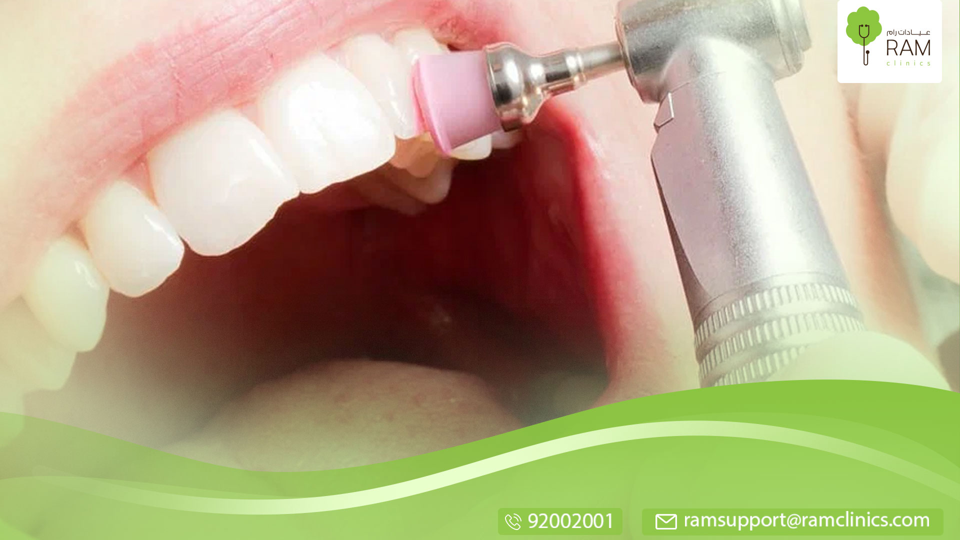 طرق تنظيف الأسنان من الجير