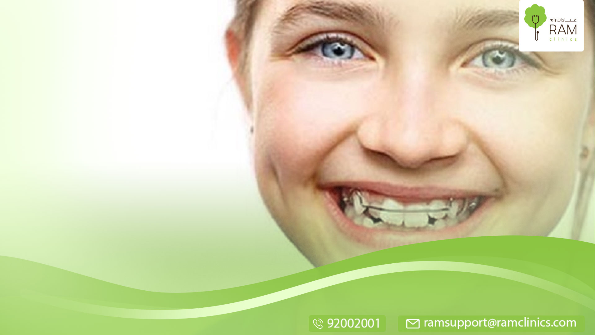 تقويم الأسنان للأطفال