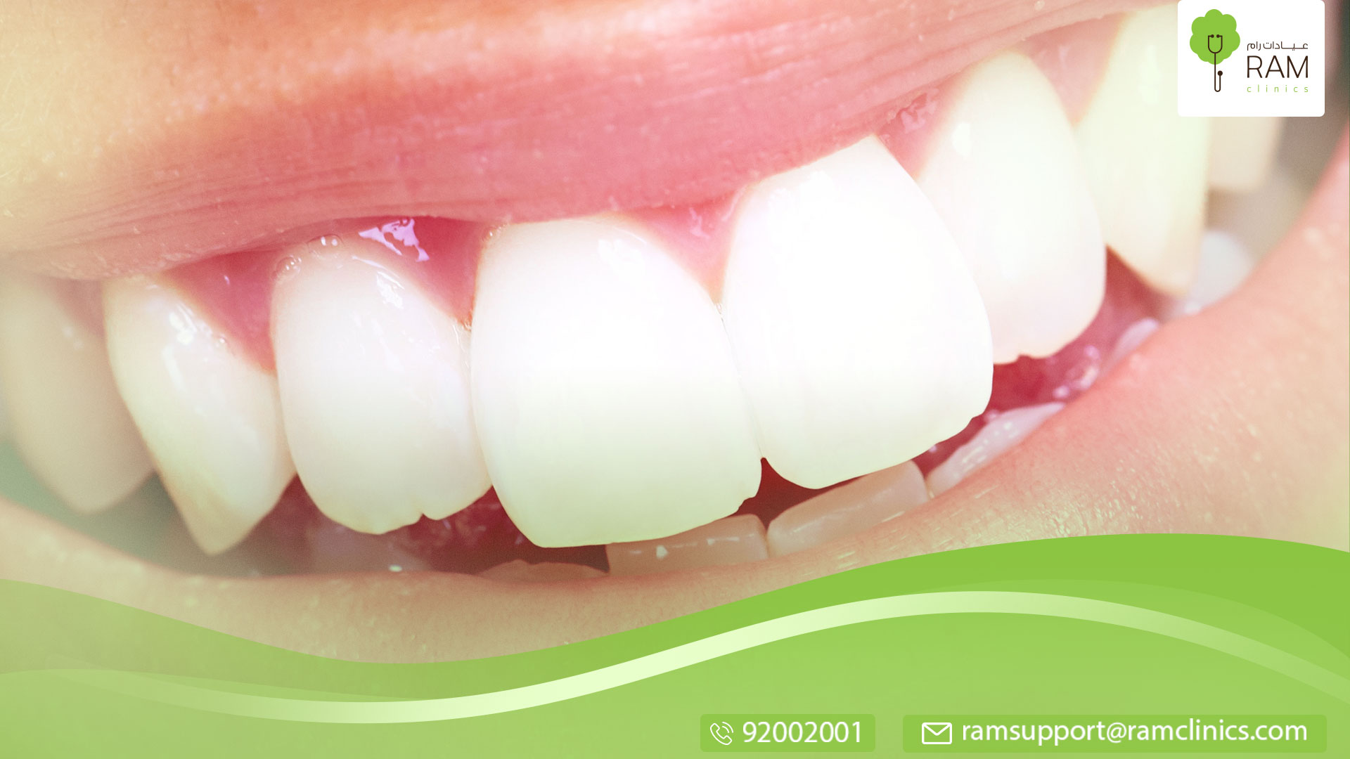 نصائح تقوية الأسنان