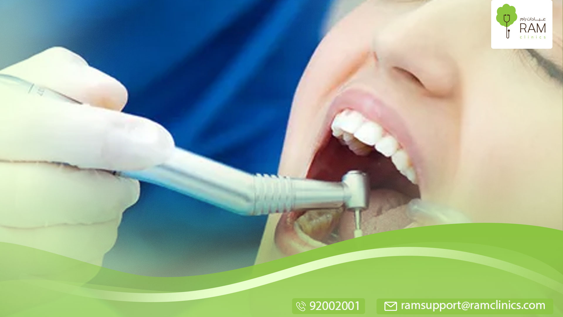 معلومات عن تصدع الأسنان