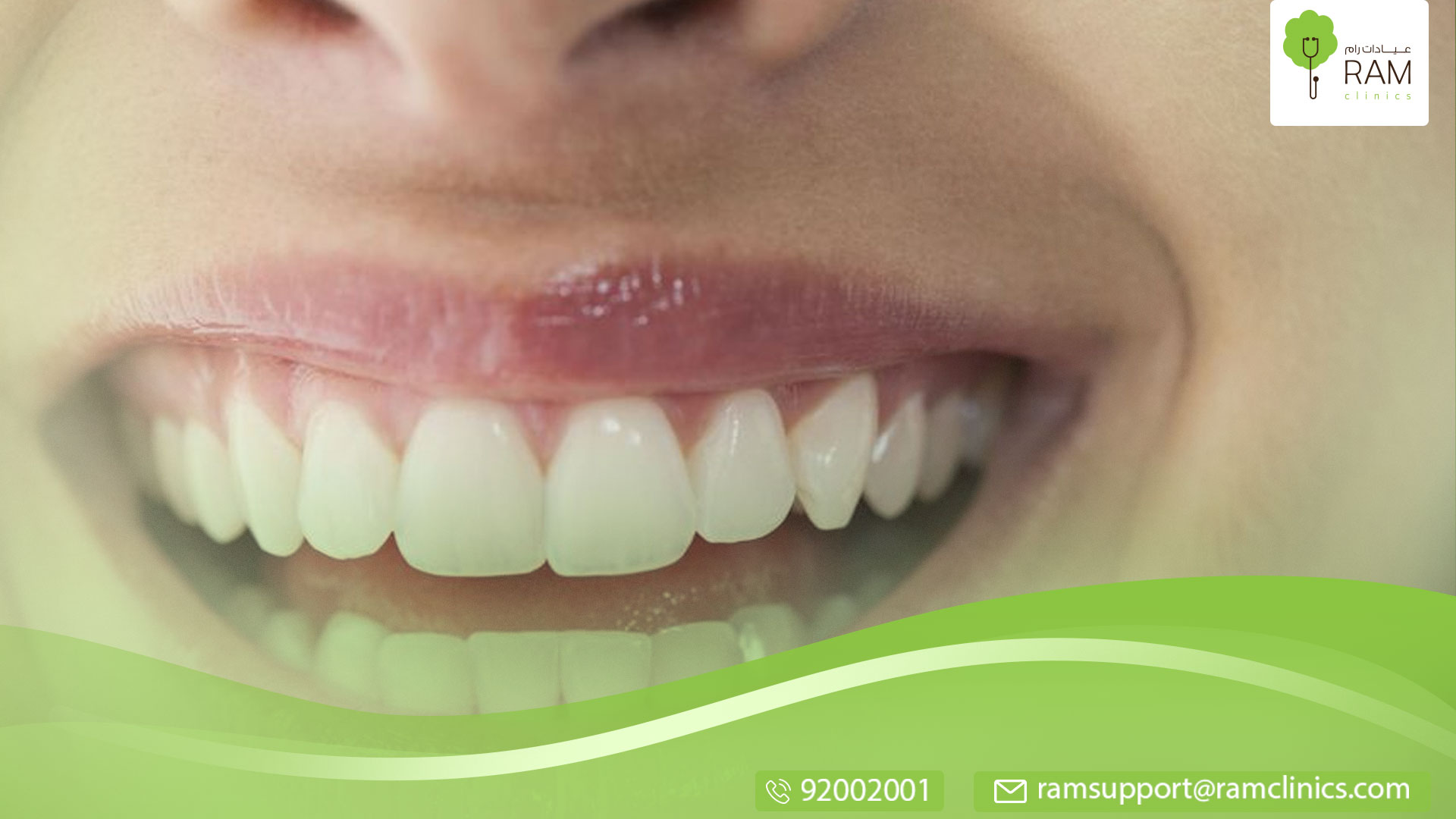 اسباب ازدحام الأسنان