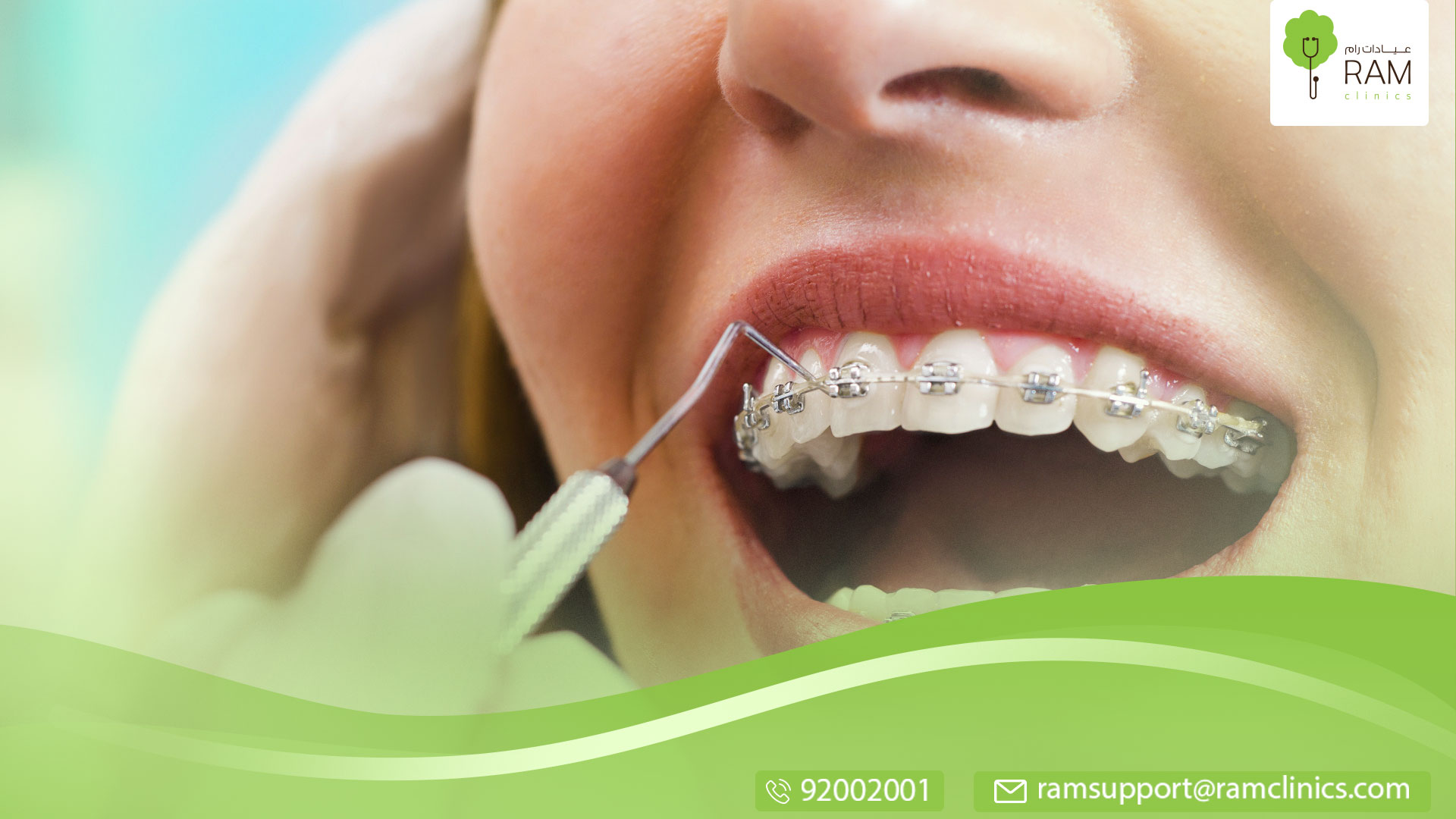 مراحل تقويم الأسنان