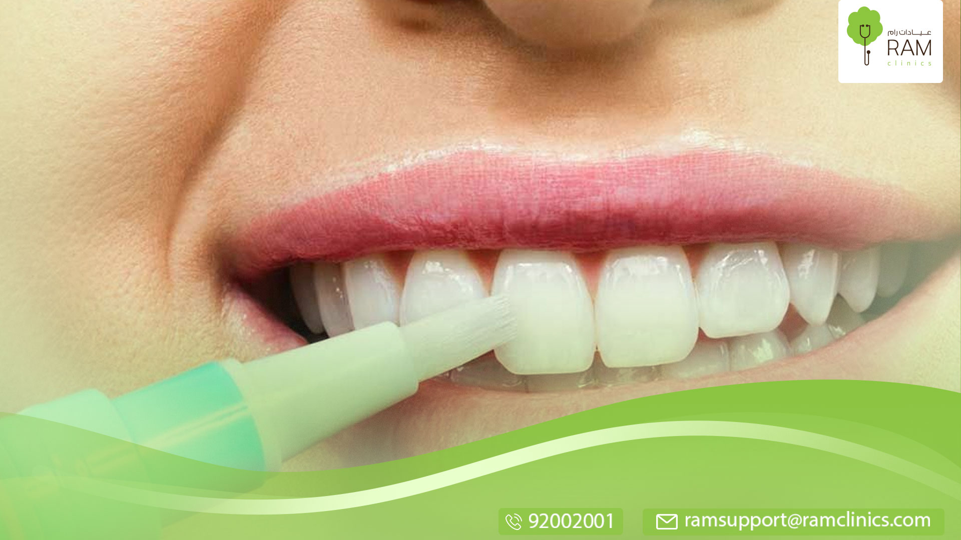 قلم تبييض الأسنان