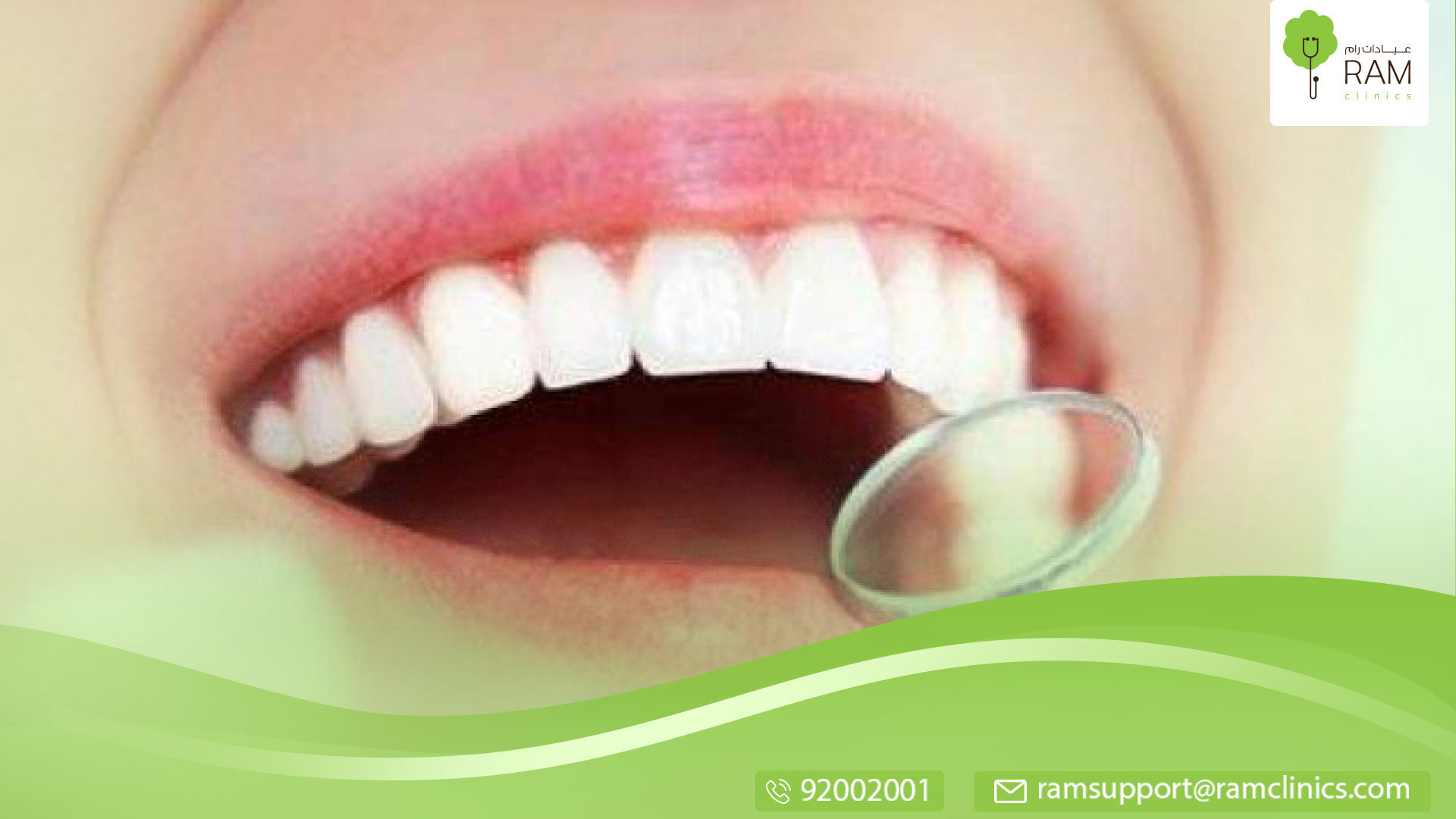 علاج بروز الأسنان الأمامية