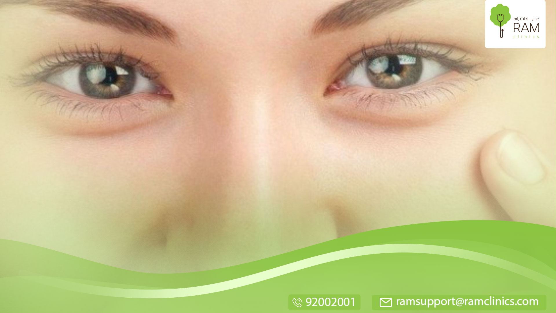 سبب حول العين المفاجئ