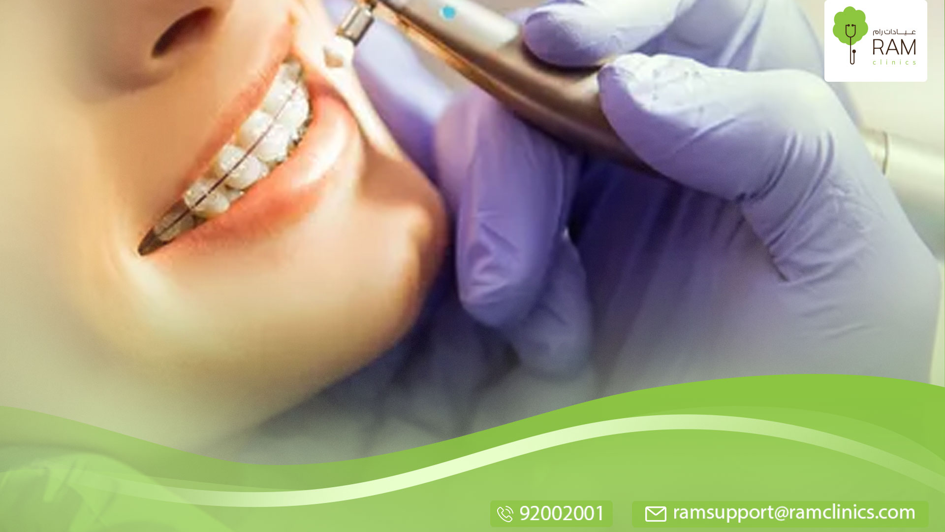 طرق تجميل الأسنان