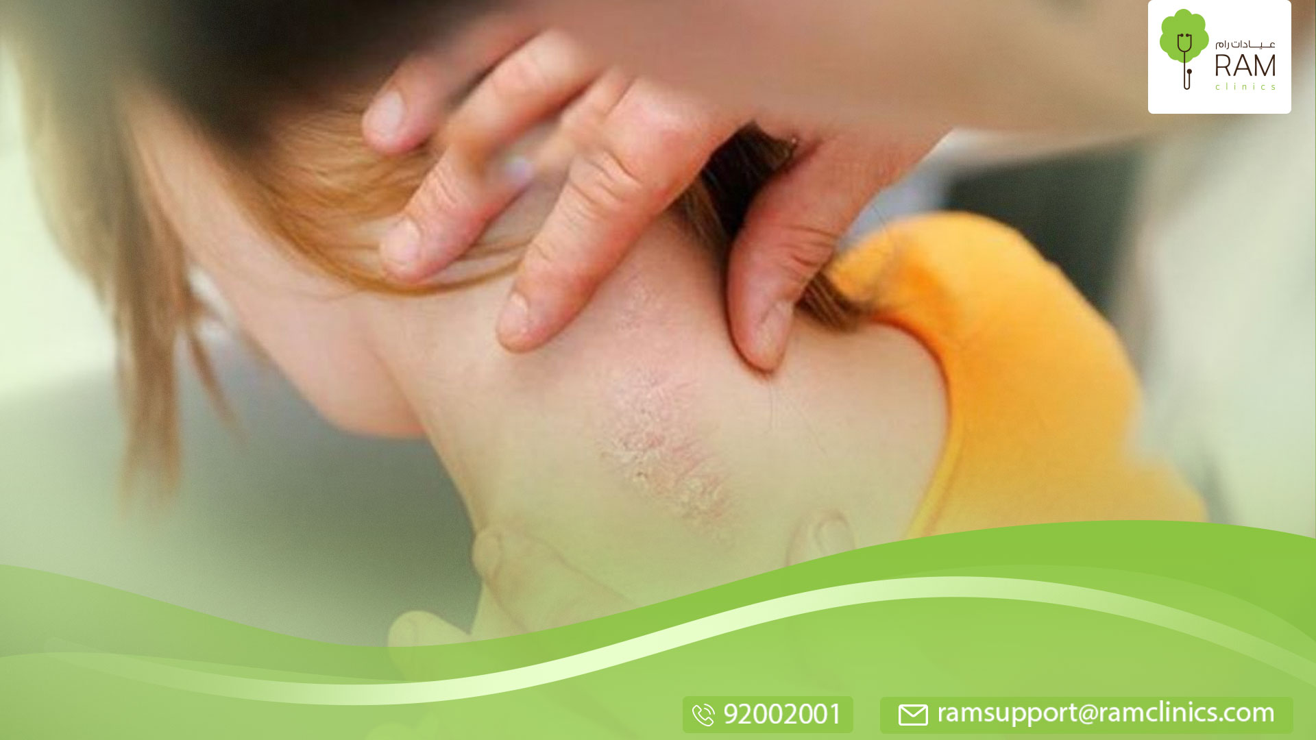 أبرز أنواع الفطريات الجلدية