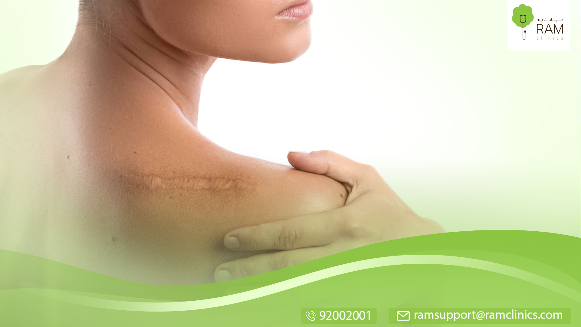 تعرف علي علاج التصبغات الجلدية