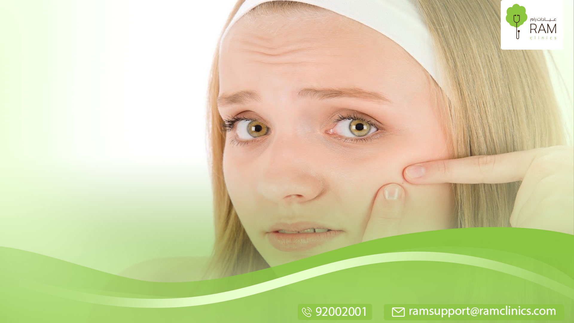 علاج آثار حب الشباب