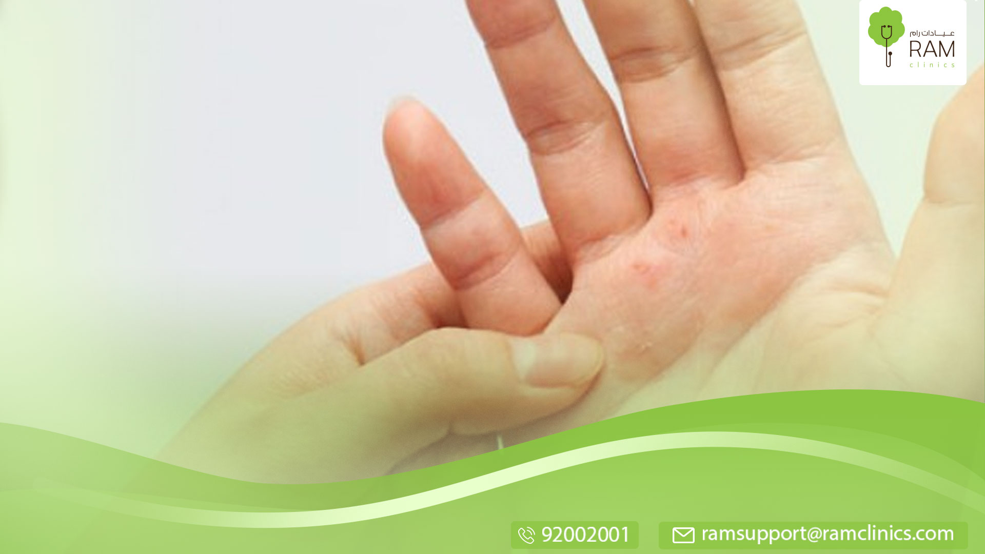 علاج الصدفية بالكركم