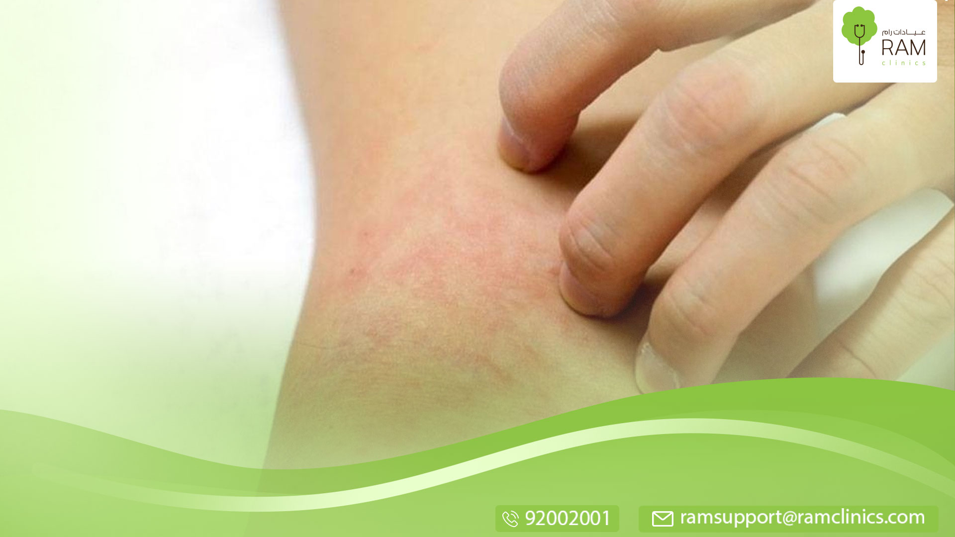 علاج التهاب الجلد